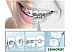 Сменная насадка Panasonic WEW0984W303 Сменная насадка Panasonic WEW0984W303
